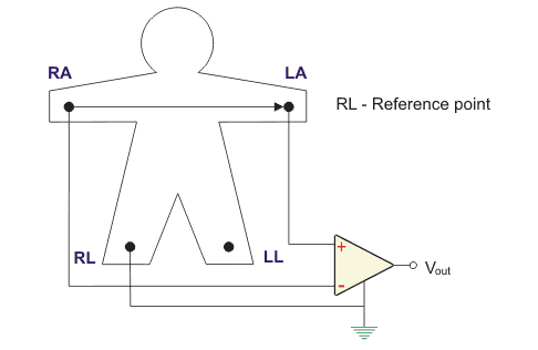 双极肢引线或标准I引线