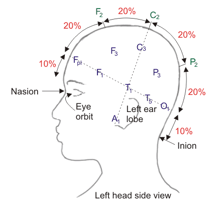 脑电图引导系统